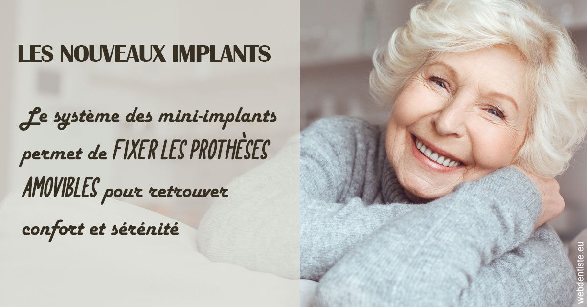 https://www.dentiste-neuville.fr/Les nouveaux implants 1