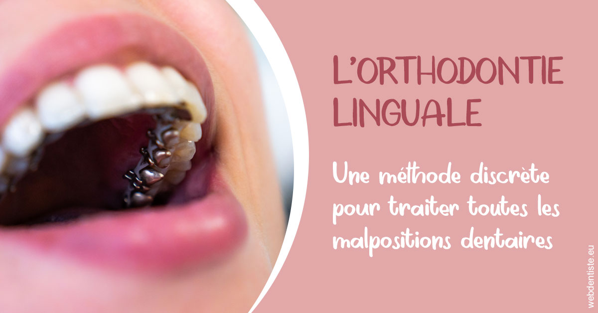https://www.dentiste-neuville.fr/L'orthodontie linguale 2