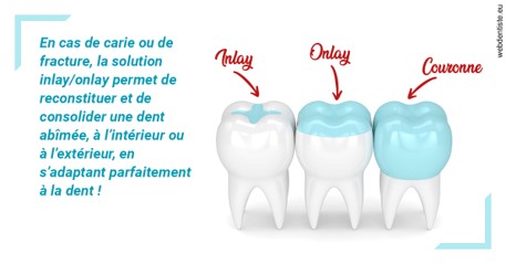 https://www.dentiste-neuville.fr/L'INLAY ou l'ONLAY