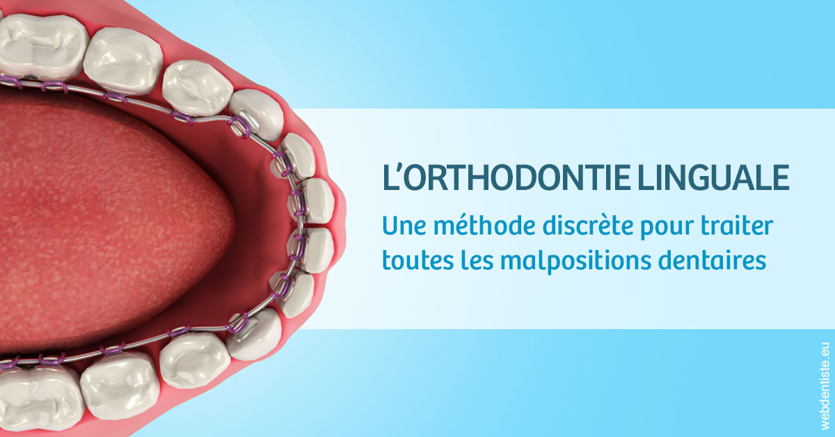 https://www.dentiste-neuville.fr/L'orthodontie linguale 1