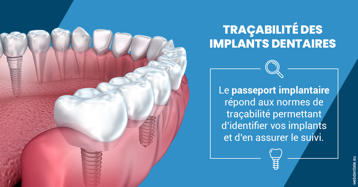 https://www.dentiste-neuville.fr/T2 2023 - Traçabilité des implants 1