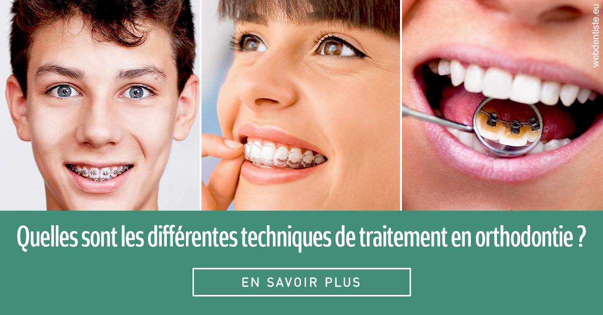 https://www.dentiste-neuville.fr/Les différentes techniques de traitement 2