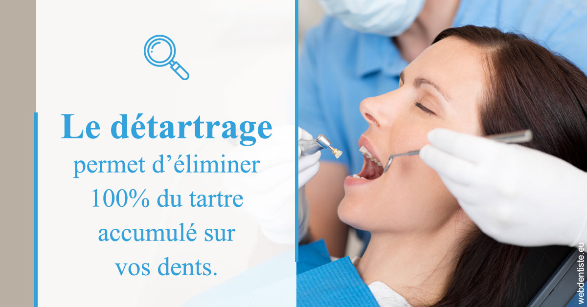 https://www.dentiste-neuville.fr/En quoi consiste le détartrage
