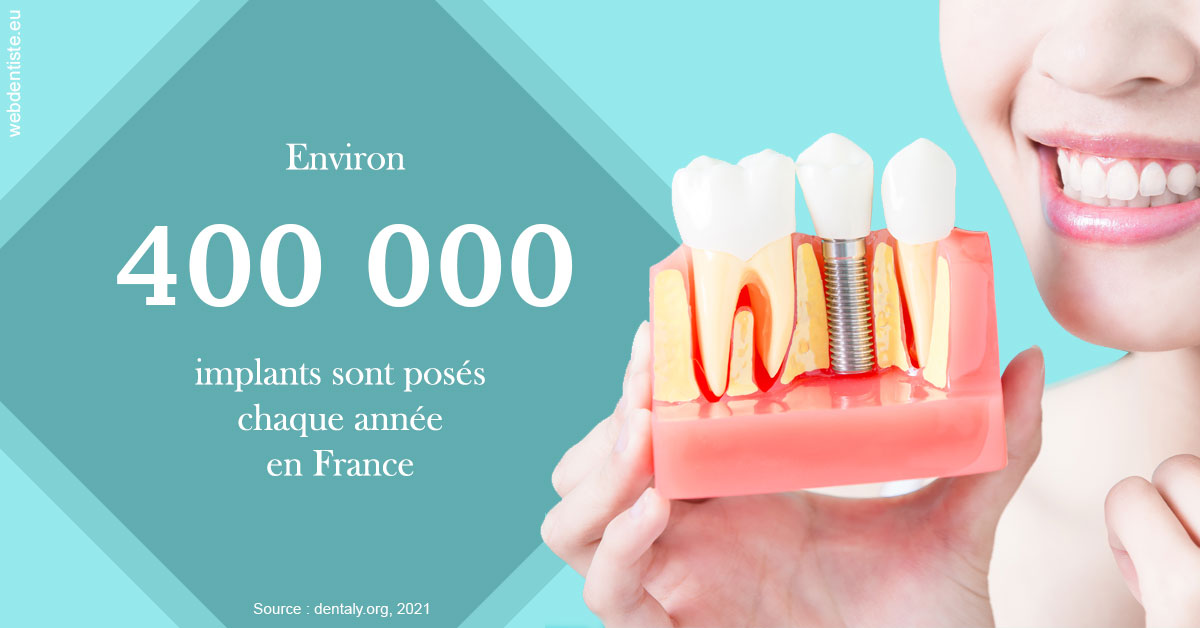 https://www.dentiste-neuville.fr/Pose d'implants en France 2