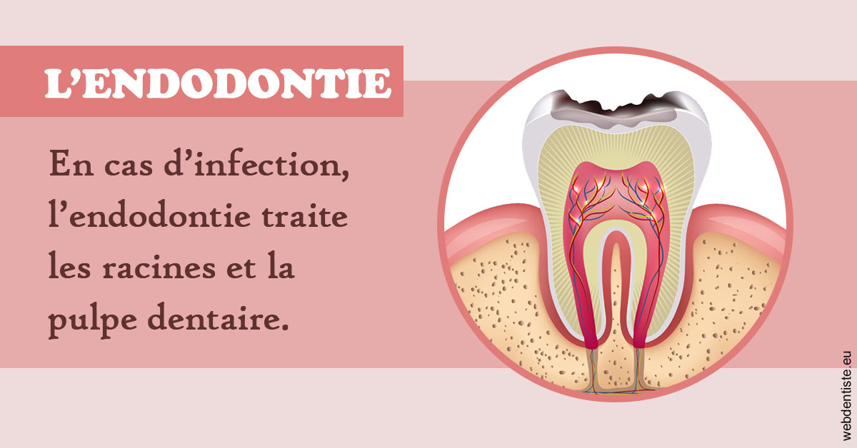 https://www.dentiste-neuville.fr/L'endodontie 2