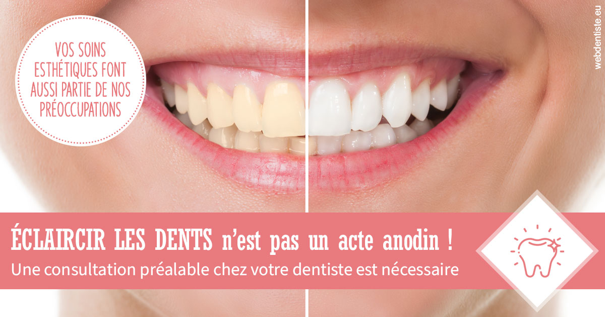 https://www.dentiste-neuville.fr/Eclaircir les dents 1