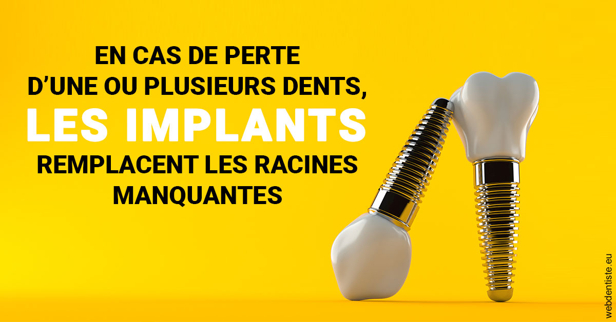 https://www.dentiste-neuville.fr/Les implants 2