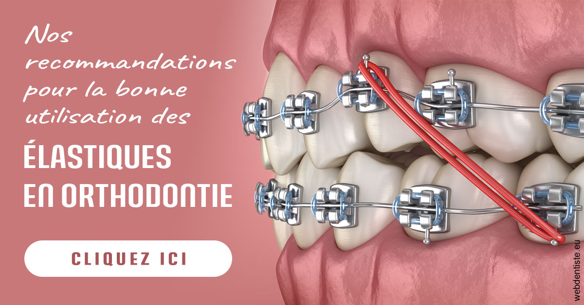 https://www.dentiste-neuville.fr/Elastiques orthodontie 2