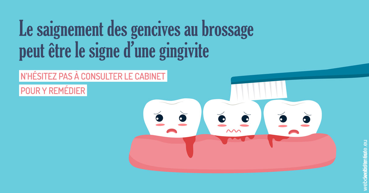 https://www.dentiste-neuville.fr/2023 T4 - Saignement des gencives 02