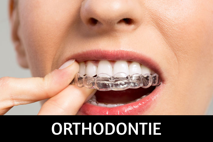 OrthodontiePNG