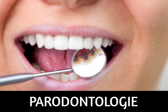 ParodontologiePNG
